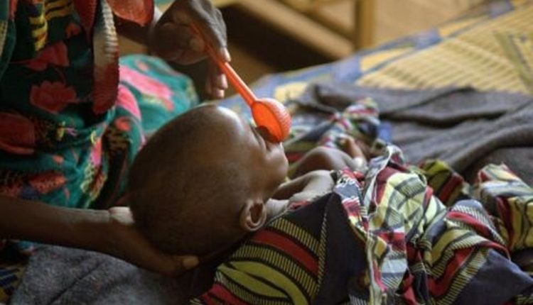 malnutrition au niger